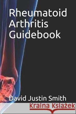 Rheumatoid Arthritis Guidebook David Justin Smith 9781980471844 Independently Published - książka