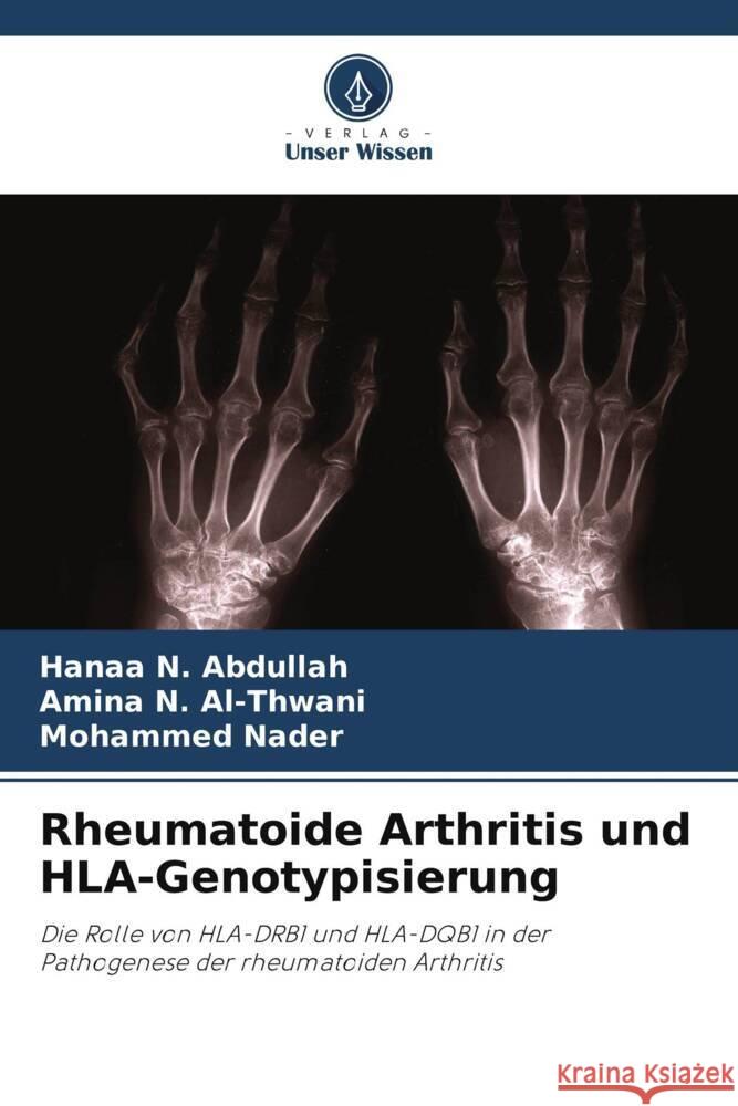 Rheumatoide Arthritis und HLA-Genotypisierung Hanaa N. Abdullah Amina N. Al-Thwani Mohammed Nader 9786208013967 Verlag Unser Wissen - książka