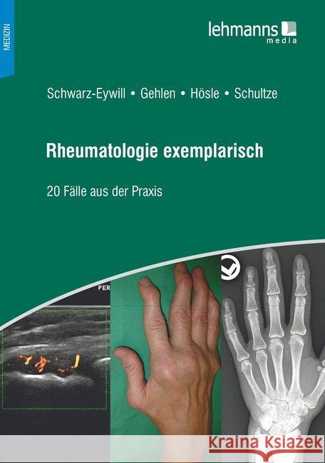 Rheumatologie exemplarisch : 20 Fälle aus der Praxis Schwarz-Eywill, Michael; Gehlen, Martin; Hösle, Rosmarie 9783965430624 Lehmanns Media - książka