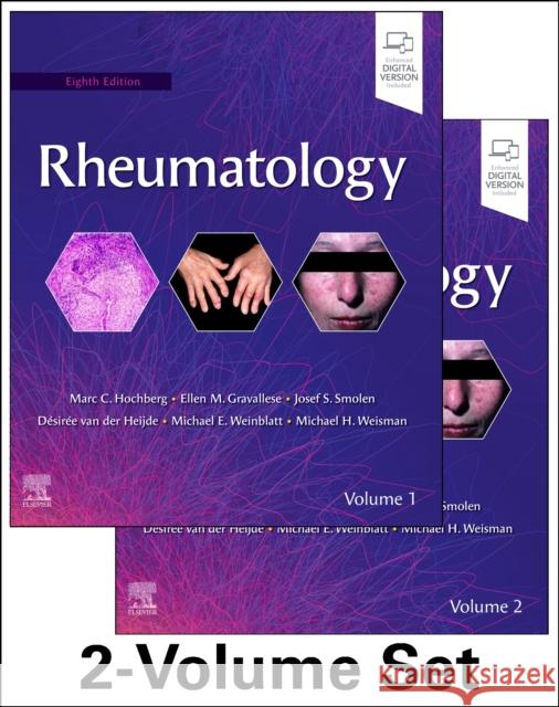 Rheumatology, 2-Volume Set Marc C. Hochberg Josef S. Smolen Michael E. Weinblatt 9780702081330 Elsevier Health Sciences - książka