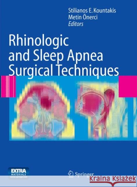 Rhinologic and Sleep Apnea Surgical Techniques Stilianos E. Kountakis T. Metin Onerci 9783662500385 Springer - książka