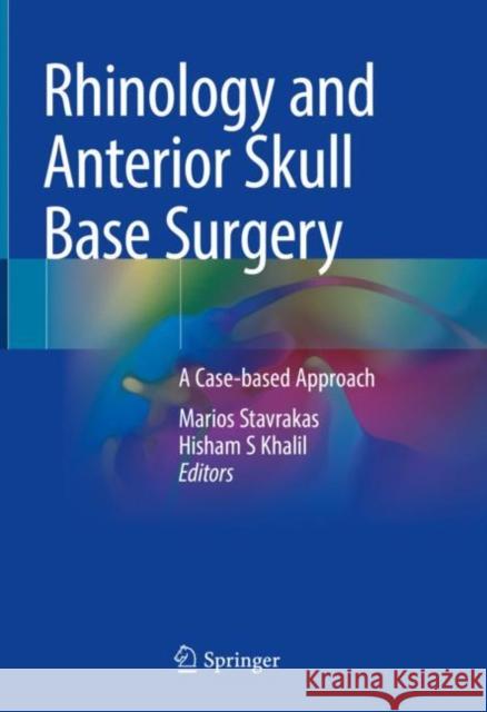 Rhinology and Anterior Skull Base Surgery: A Case-Based Approach Marios Stavrakas Hisham S. Khalil 9783030668648 Springer - książka