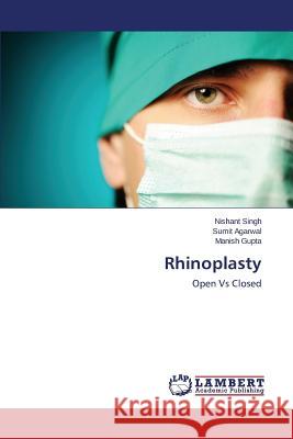 Rhinoplasty Singh Nishant 9783659539602 LAP Lambert Academic Publishing - książka