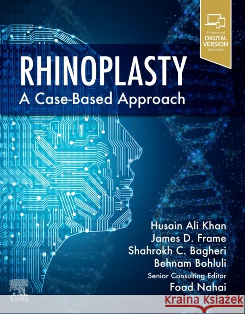 Rhinoplasty: a Case-based approach  9780323697750 Elsevier - książka