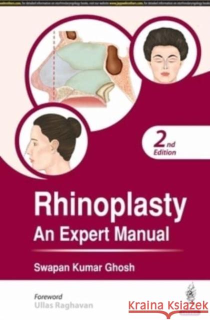 Rhinoplasty: An Expert Manual Swapan Kumar Ghosh 9789354652110 Jaypee Brothers Medical Publishers - książka