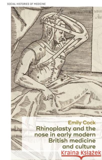 Rhinoplasty and the Nose in Early Modern British Medicine and Culture Emily Cock 9781526137166 Manchester University Press - książka