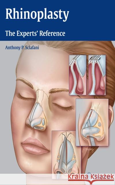 Rhinoplasty: The Experts' Reference Sclafani, Anthony P. 9781604068672 Thieme Medical Publishers - książka