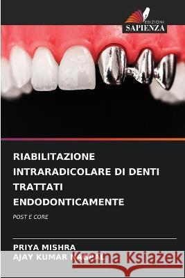 Riabilitazione Intraradicolare Di Denti Trattati Endodonticamente Priya Mishra Ajay Kumar Nagpal  9786206027355 Edizioni Sapienza - książka