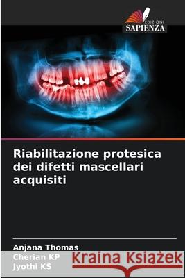 Riabilitazione protesica dei difetti mascellari acquisiti Anjana Thomas, Cherian Kp, Jyothi Ks 9786204154886 Edizioni Sapienza - książka