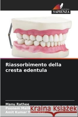 Riassorbimento della cresta edentula Rathee, Manu, Malik, Poonam, Tamrakar, Amit Kumar 9786209229541 Edizioni Sapienza - książka