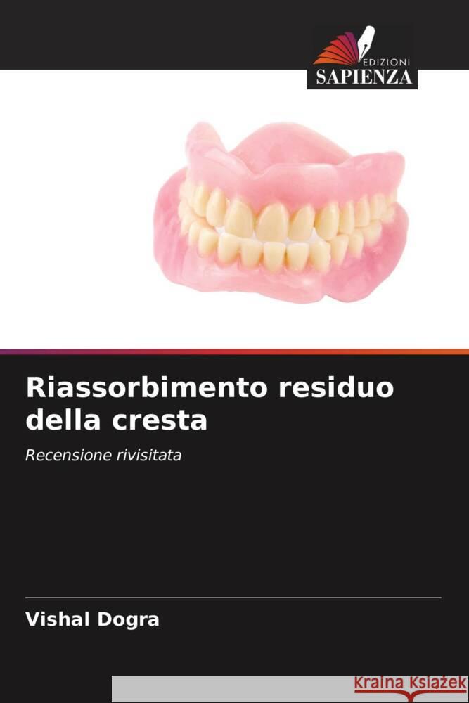 Riassorbimento residuo della cresta Vishal Dogra   9786206049951 Edizioni Sapienza - książka