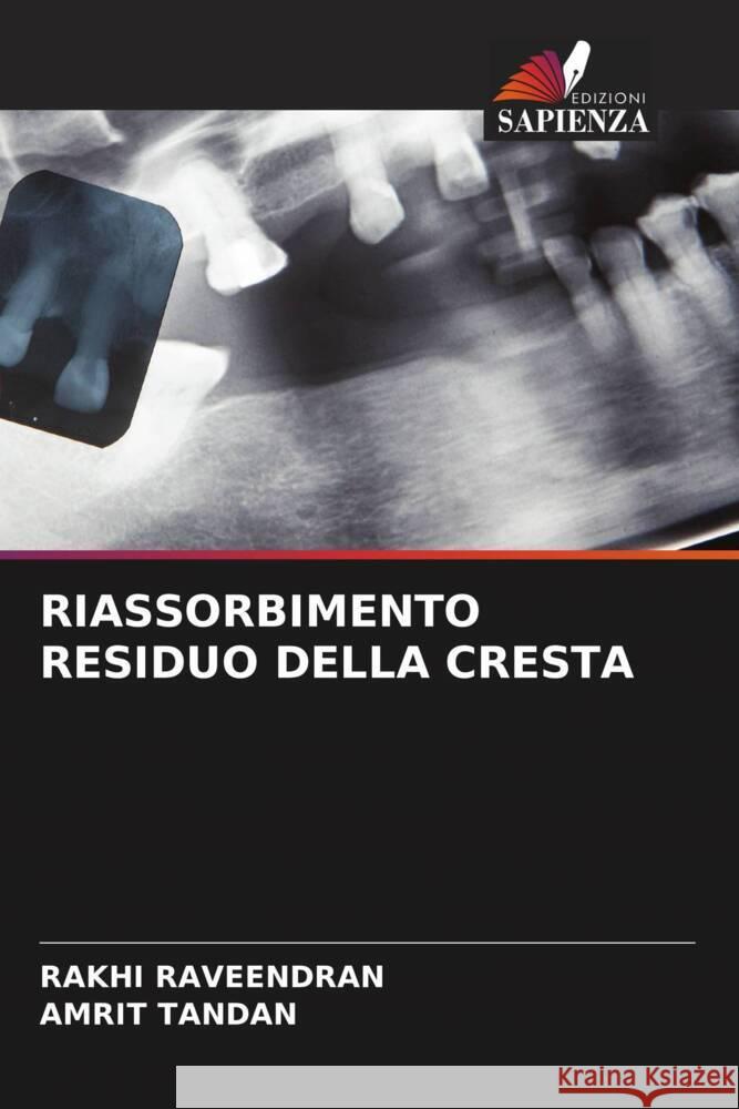 RIASSORBIMENTO RESIDUO DELLA CRESTA RAVEENDRAN, RAKHI, Tandan, Amrit 9786206293316 Edizioni Sapienza - książka