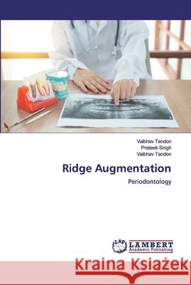 Ridge Augmentation Singh, Prateek 9786200320919 LAP Lambert Academic Publishing - książka