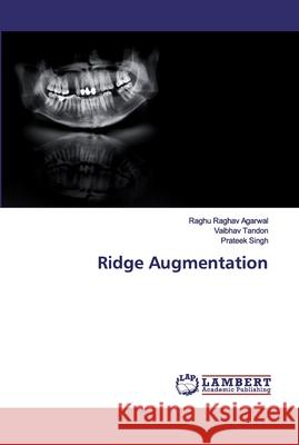 Ridge Augmentation Agarwal, Raghu Raghav; Tandon, Vaibhav; Singh, Prateek 9786200507709 LAP Lambert Academic Publishing - książka