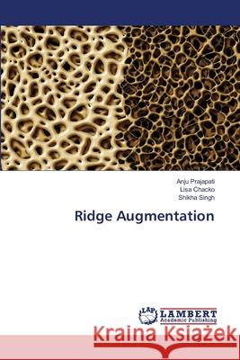 Ridge Augmentation Anju Prajapati Lisa Chacko Shikha Singh 9786202802314 LAP Lambert Academic Publishing - książka