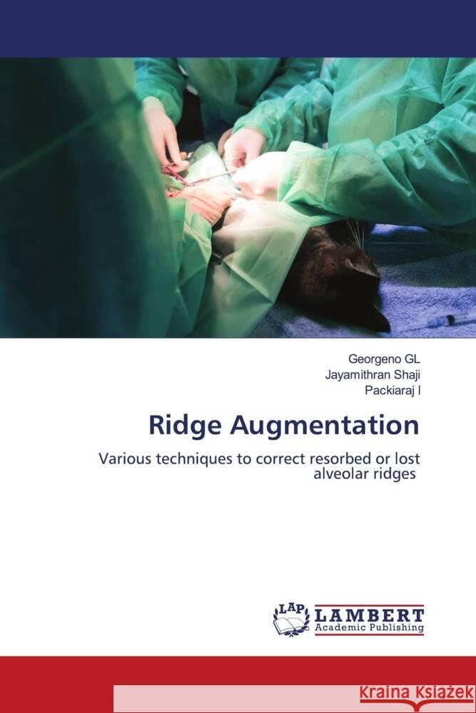 Ridge Augmentation Georgeno Gl Jayamithran Shaji Packiaraj I 9786207451661 LAP Lambert Academic Publishing - książka