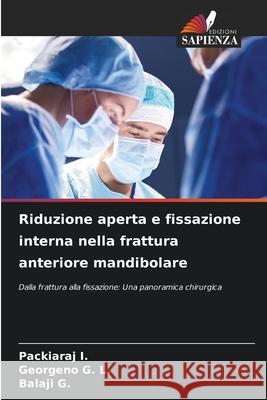 Riduzione aperta e fissazione interna nella frattura anteriore mandibolare I., Packiaraj, G. L., Georgeno, G., Balaji 9786200819796 Edizioni Sapienza - książka