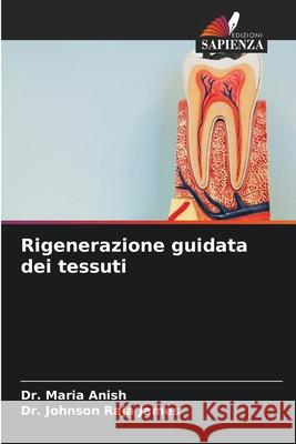Rigenerazione guidata dei tessuti Anish, Dr. Maria, James, Dr. Johnson Raja 9786202457019 Edizioni Sapienza - książka