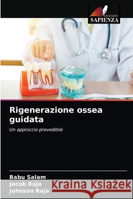 Rigenerazione ossea guidata Babu Salam Jacob Raja Johnson Raja 9786203480665 Edizioni Sapienza - książka