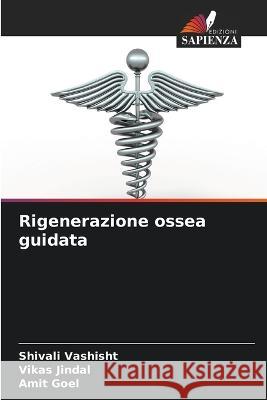 Rigenerazione ossea guidata Shivali Vashisht Vikas Jindal Amit Goel 9786205619537 Edizioni Sapienza - książka