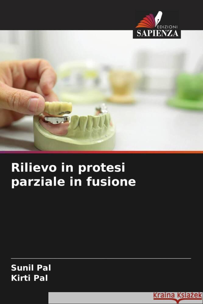 Rilievo in protesi parziale in fusione Pal, Sunil, Pal, Kirti 9786204562810 Edizioni Sapienza - książka