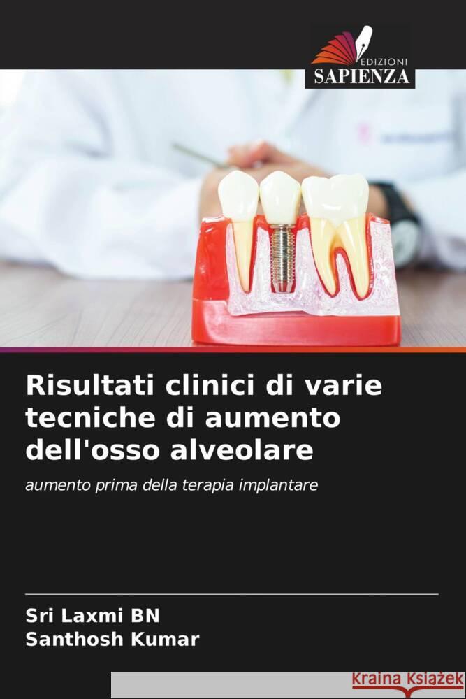 Risultati clinici di varie tecniche di aumento dell'osso alveolare Sri Laxmi Bn Santhosh Kumar 9786207281084 Edizioni Sapienza - książka