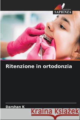 Ritenzione in ortodonzia K, Darshan 9786209073557 Edizioni Sapienza - książka