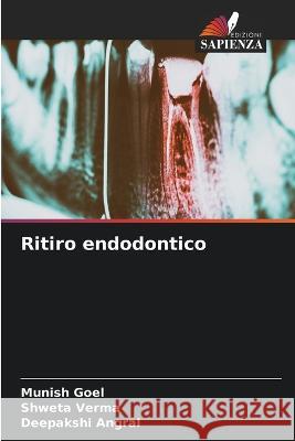 Ritiro endodontico Munish Goel Shweta Verma Deepakshi Angral 9786205965757 Edizioni Sapienza - książka