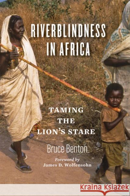 Riverblindness in Africa: Taming the Lion's Stare Bruce Benton James D. Wolfensohn 9781421439662 Johns Hopkins University Press - książka