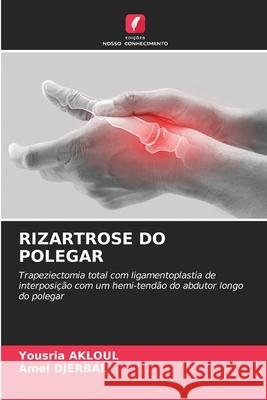 Rizartrose Do Polegar Yousria Akloul Amel Djerbal 9786207556090 Edicoes Nosso Conhecimento - książka