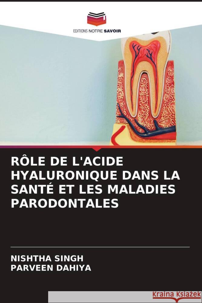 RÔLE DE L'ACIDE HYALURONIQUE DANS LA SANTÉ ET LES MALADIES PARODONTALES Singh, Nishtha, Dahiya, Parveen 9786205470596 Editions Notre Savoir - książka