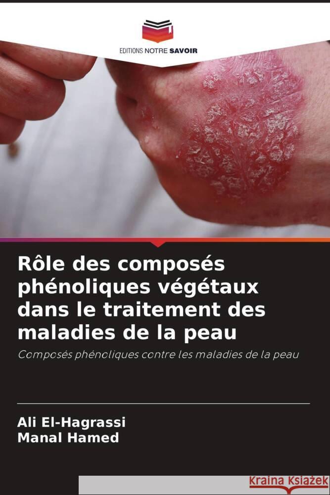 R?le des compos?s ph?noliques v?g?taux dans le traitement des maladies de la peau Ali El-Hagrassi Manal Hamed 9786206884323 Editions Notre Savoir - książka