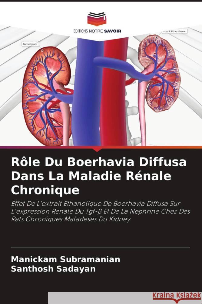 R?le Du Boerhavia Diffusa Dans La Maladie R?nale Chronique Manickam Subramanian Santhosh Sadayan 9786207431694 Editions Notre Savoir - książka