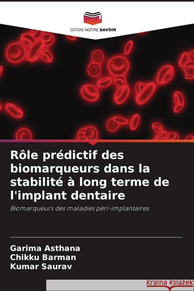 Rôle prédictif des biomarqueurs dans la stabilité à long terme de l'implant dentaire Asthana, Garima, Barman, Chikku, Saurav, Kumar 9786205189887 Editions Notre Savoir - książka