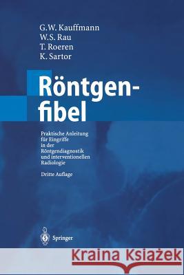 Röntgenfibel: Praktische Anleitung Für Eingriffe in Der Röntgendiagnostik Und Interventionellen Radiologie Kauffmann, G. W. 9783642624889 Springer - książka