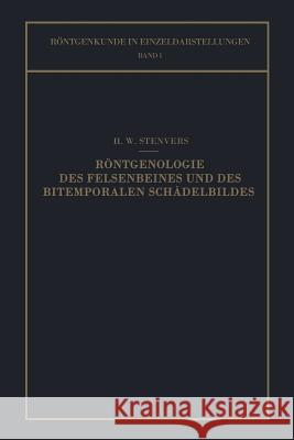 Röntgenologie Des Felsenbeines Und Des Bitemporalen Schädelbildes: Mit Besonderer Berücksichtigung Ihrer Klinischen Bedeutung Stenvers, H. W. 9783662282625 Springer - książka