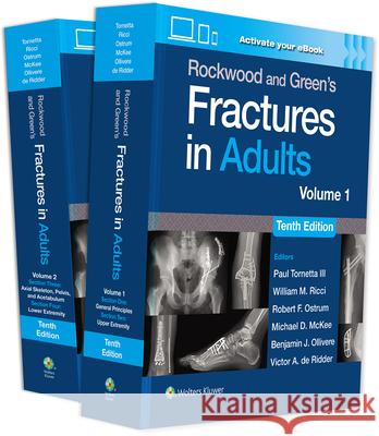 Rockwood and Green's Fractures in Adults: Print + eBook with Multimedia Paul, MD, III Tornetta 9781975211608 Wolters Kluwer Health - książka