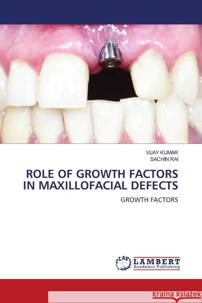 ROLE OF GROWTH FACTORS IN MAXILLOFACIAL DEFECTS Kumar, Vijay, RAI, SACHIN 9786204732558 LAP Lambert Academic Publishing - książka