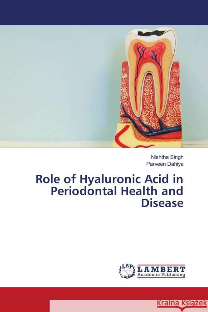 Role of Hyaluronic Acid in Periodontal Health and Disease Singh, Nishtha, Dahiya, Parveen 9786205517741 LAP Lambert Academic Publishing - książka