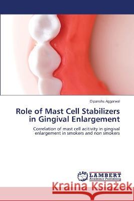 Role of Mast Cell Stabilizers in Gingival Enlargement Aggarwal, Dipanshu 9786206155485 LAP Lambert Academic Publishing - książka