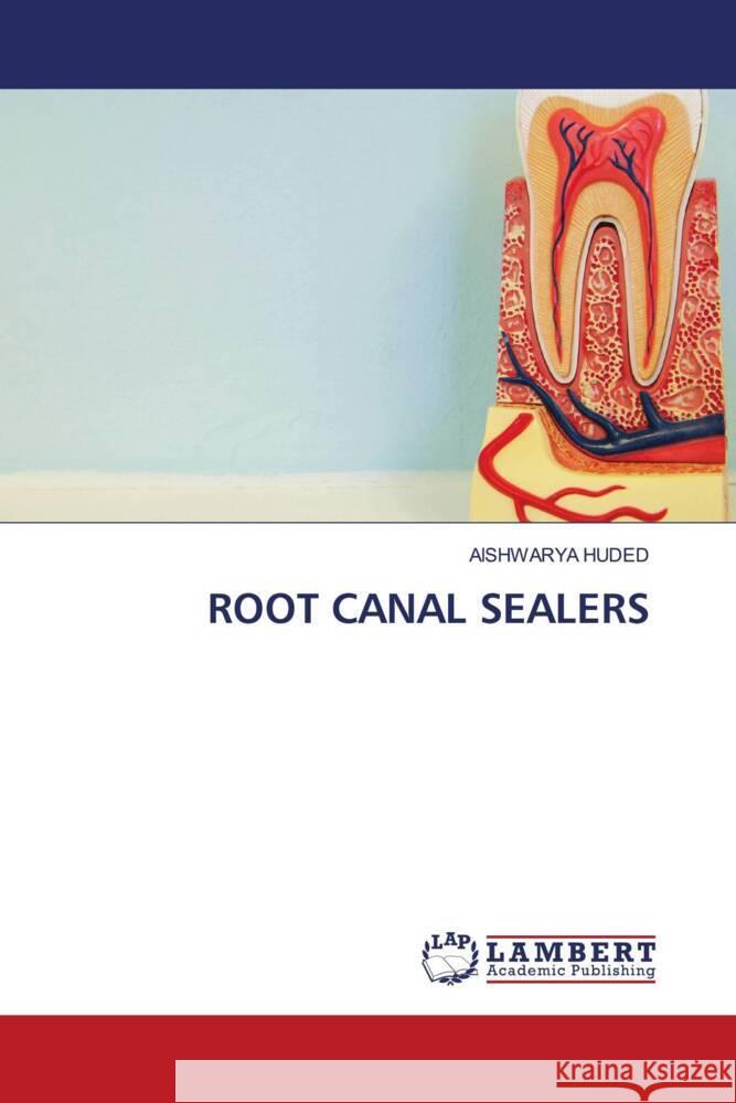 ROOT CANAL SEALERS HUDED, AISHWARYA 9786208170394 LAP Lambert Academic Publishing - książka