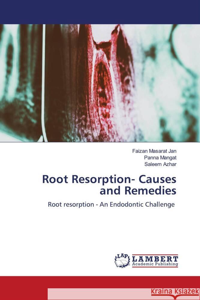 Root Resorption- Causes and Remedies Masarat Jan, Faizan, Mangat, Panna, Azhar, Saleem 9786203854671 LAP Lambert Academic Publishing - książka