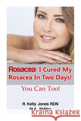 Rosacea: I Cured My Rosacea In Two Days! You Can Too! Kelly, Cavenaugh 9781508463283 Createspace - książka