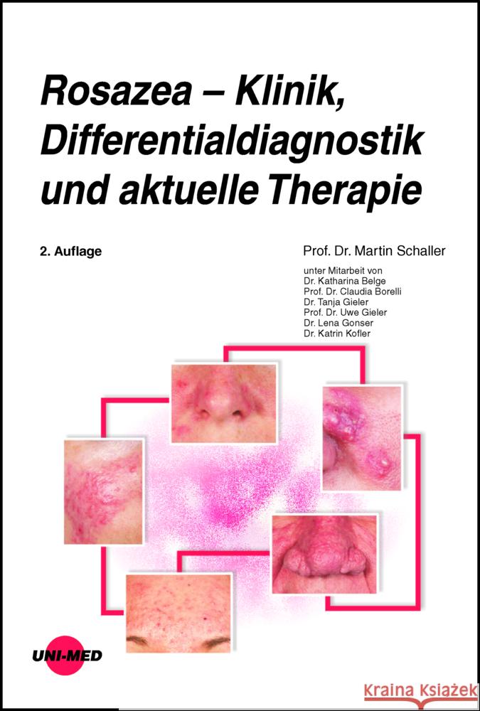 Rosazea - Klinik, Differentialdiagnostik und aktuelle Therapie Schaller, Martin 9783837424256 UNI-MED, Bremen - książka