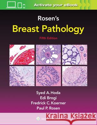 Rosen's Breast Pathology Syed Hoda 9781496398918 LWW - książka