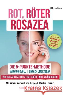 ROT RÖTER ROSAZEA Wienpahl, Sabine 9783746992846 tredition - książka