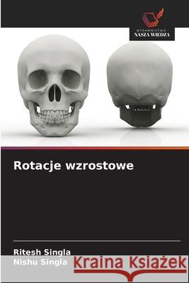 Rotacje wzrostowe Singla, Ritesh, Singla, Nishu 9786209353376 Wydawnictwo Nasza Wiedza - książka