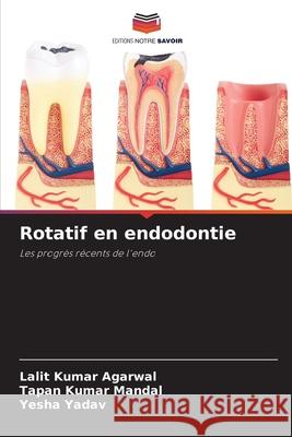 Rotatif en endodontie Lalit Kumar Agarwal, Tapan Kumar Mandal, Yesha Yadav 9786204174358 Editions Notre Savoir - książka
