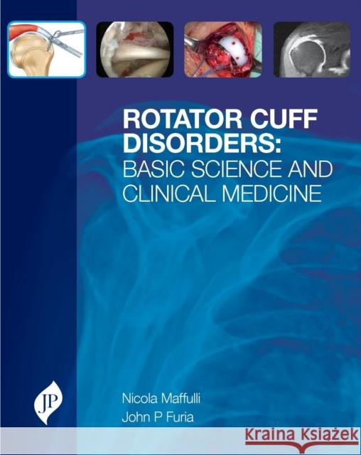 Rotator Cuff Disorders: Basic Science and Clinical Medicine Maffulli, Nicola 9781907816086  - książka