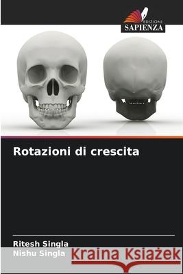 Rotazioni di crescita Singla, Ritesh, Singla, Nishu 9786209350818 Edizioni Sapienza - książka